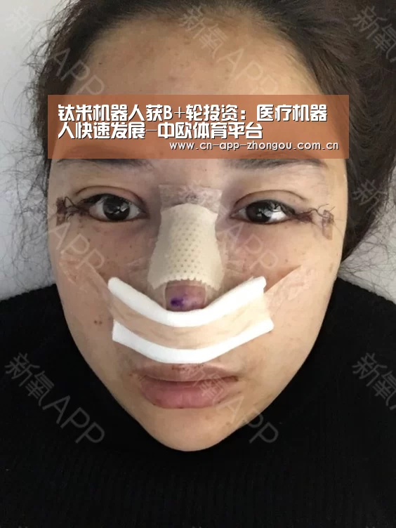 钛米机器人获B+轮投资:医疗机器人快速发展-中欧体育平台(图3) 中欧体育官网